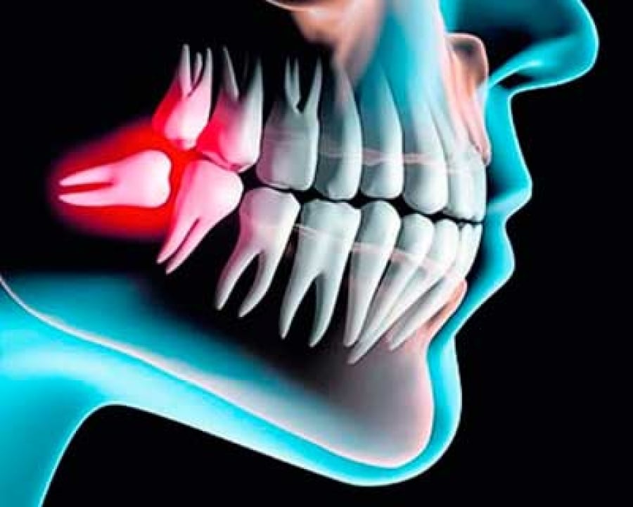 imagen de cirugia oral clinica dental san sebastian