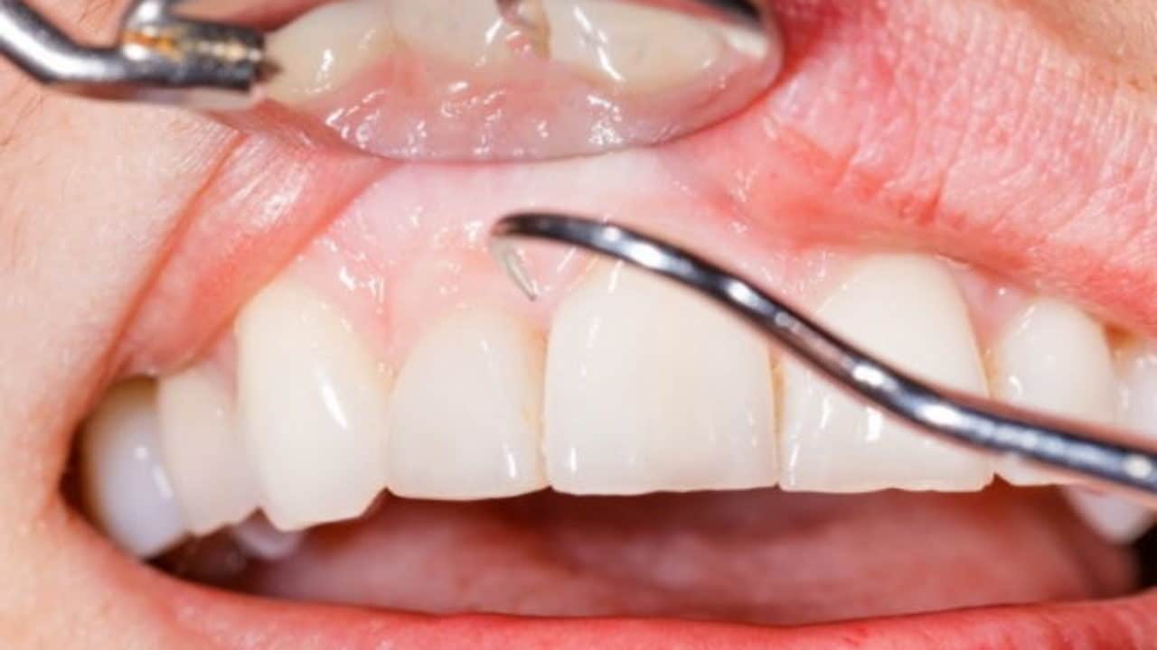 imagen de odontologia preventiva clinica san sebastian