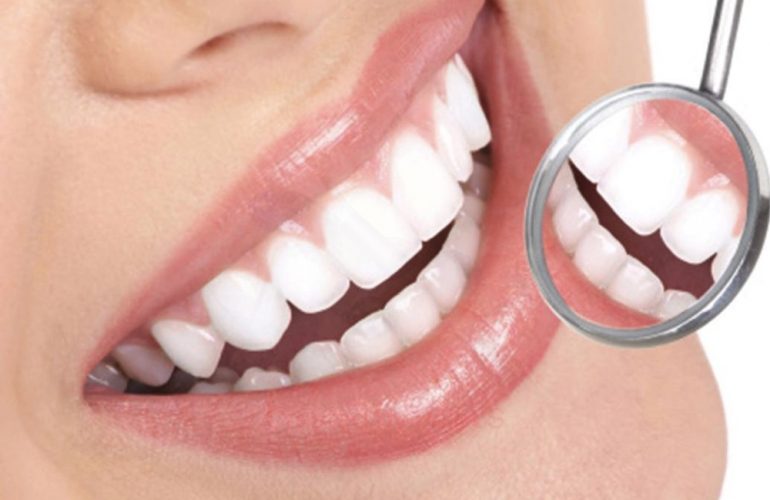 imagen de estetica dental clinica san sebastian