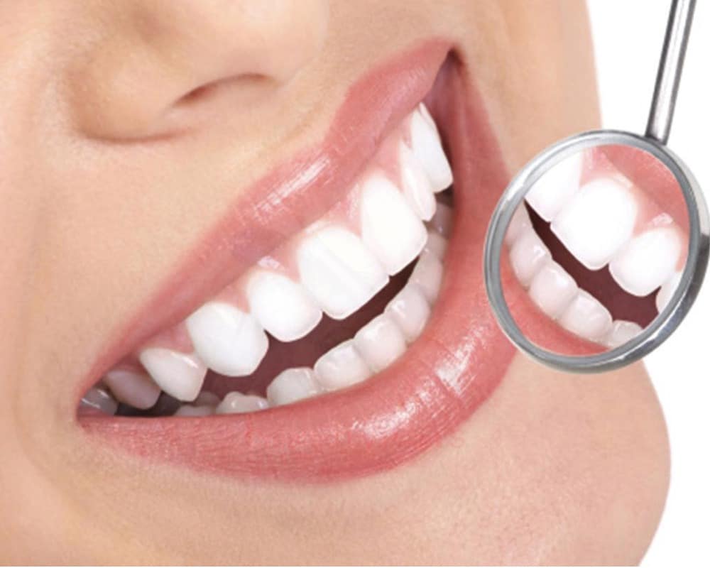 imagen de estetica dental clinica san sebastian